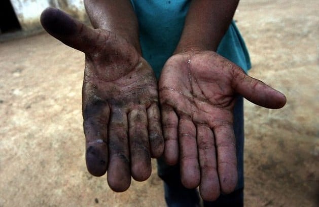 Um trabalhador de uma plantação de mandioca em Pesqueira, Estado de Pernambuco, no Nordeste do Brasil, mostra suas mãos destruídas, que denunciam seu trabalho em regime de escravidão. Foto: Alejandro Arigón/IPS