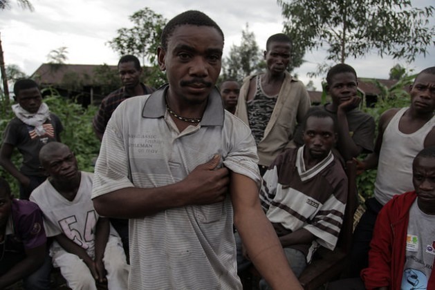 Homem mostra onde foi ferido por um guarda florestal do Parque Nacional de Virunga, na República Democrática do Congo. Foto: ZahraMoloo/IPS