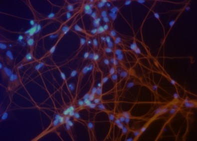 Segundo os autores do estudo, divulgado na revista Scientific Reports, o material poderá ser usado em terapia, desenvolvimento de novos medicamentos e estudos de doenças (imagem: neurônios derivados das células-tronco pluripotentes (núcleos em azul))